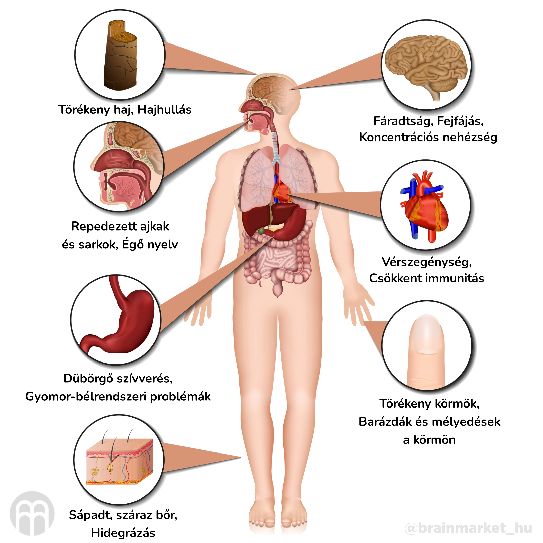 nedostatek zeleza_infografika_hu